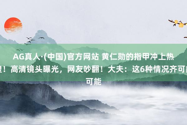 AG真人·(中国)官方网站 黄仁勋的指甲冲上热搜！高清镜头曝光，网友吵翻！大夫：这6种情况齐可能